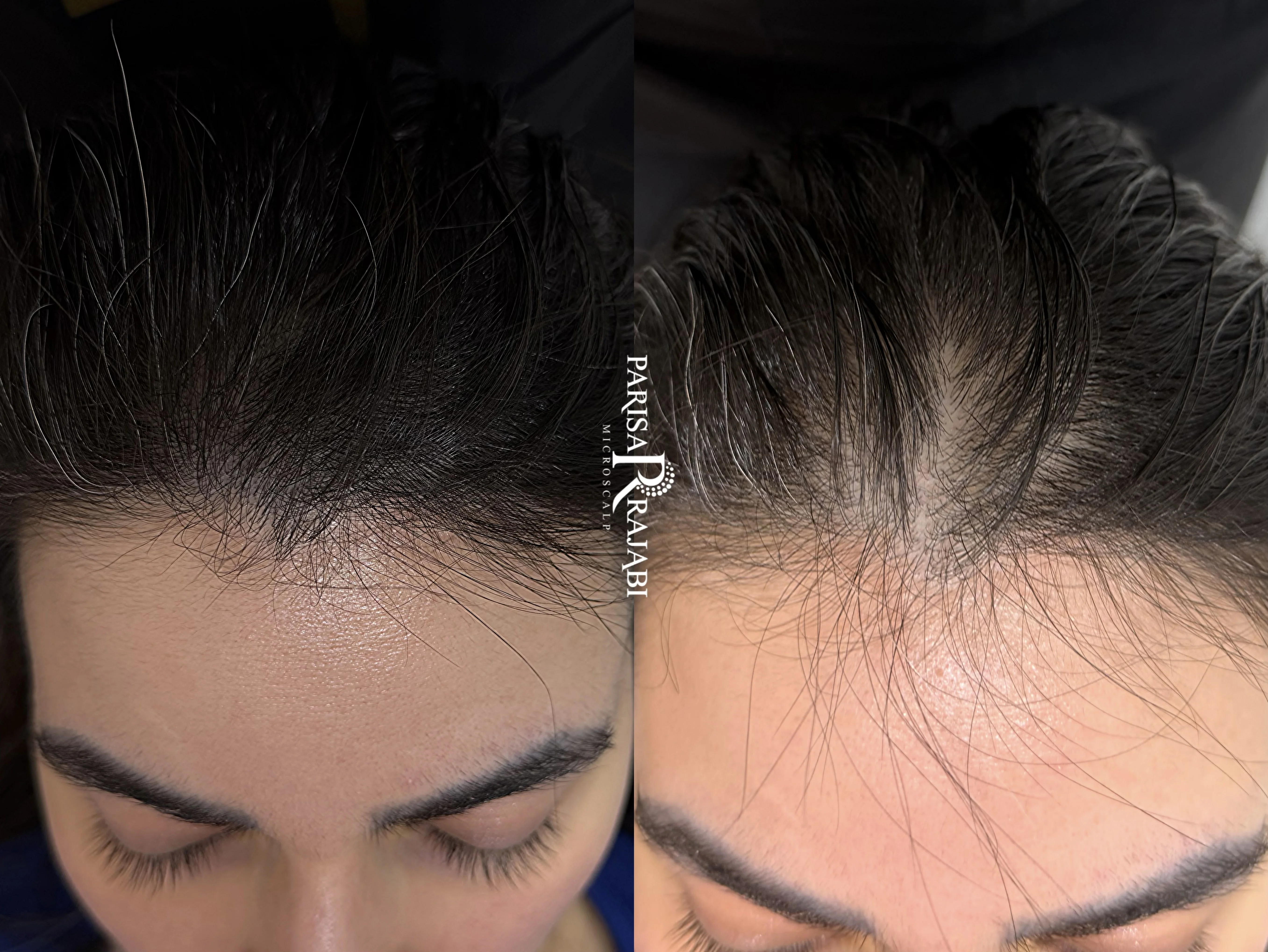 پوشش اسکار و جای بخیه